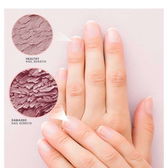 Zoya, Qtica, Smart Spa - Zoya NM Rescue & Repair Save My Nails Kit