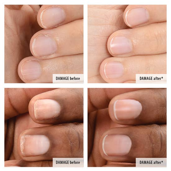 Zoya, Qtica, Smart Spa - Zoya NM Rescue & Repair Save My Nails Kit